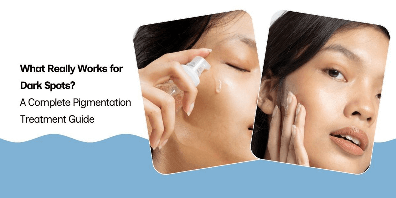 What Really Works for Dark Spots? A Complete Pigmentation Treatment Guide