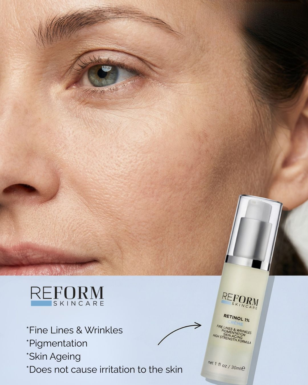 The Benefits of REFORM Skincare Retinol 1%.  How to use it Safely and Effictively