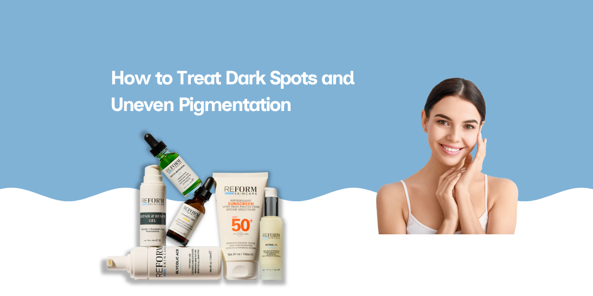 How to Treat Dark Spots and Uneven Pigmentation