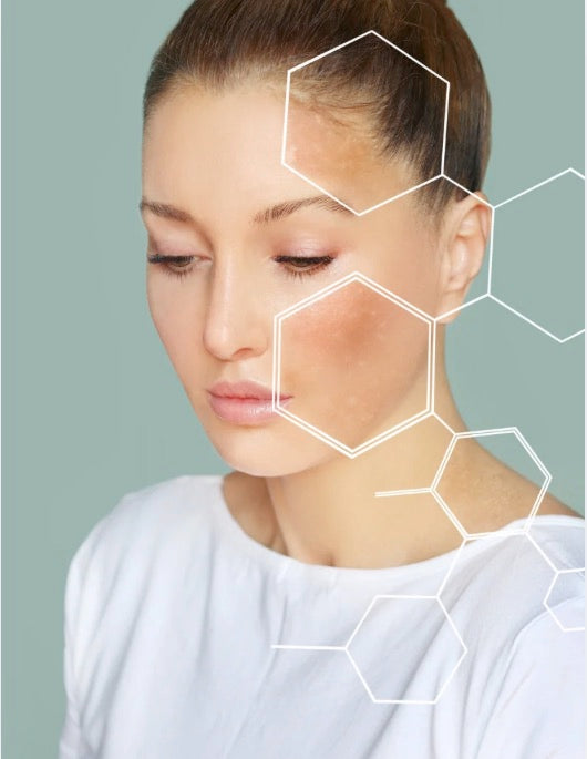 How to look after your skin in late winter and how to repair, strengthen and prepare your skin for Spring